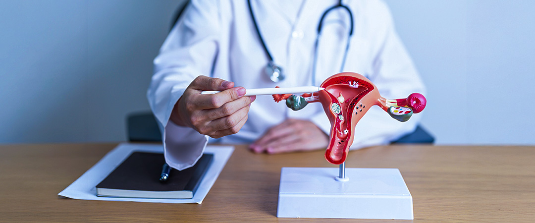 Prevención del cáncer de cuello uterino: 5 decisiones que pueden cambiar tu vida